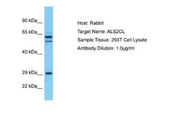 ALS2CL Rabbit anti-Human, Polyclonal, Novus Biologicals 0.1ml; Unconjugated:Antibodies,